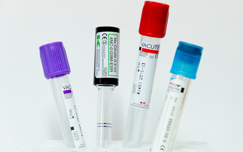 vacutainer analize medicale